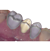 Provisional Module