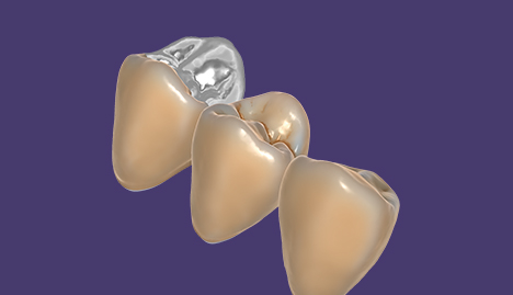 TruSmile Module